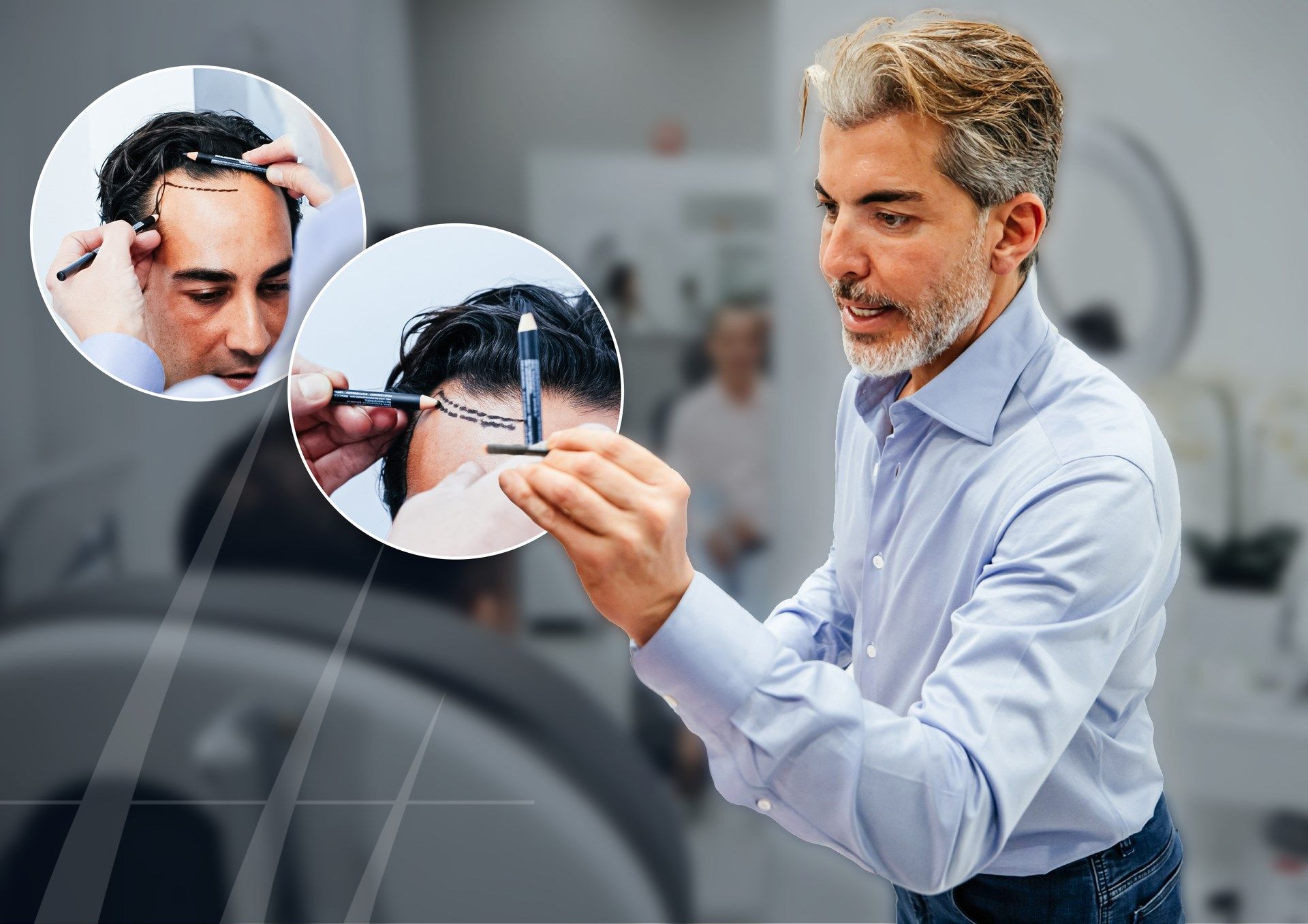 Top 10 Best Hair Transplant Clinics in Turkey for 2026